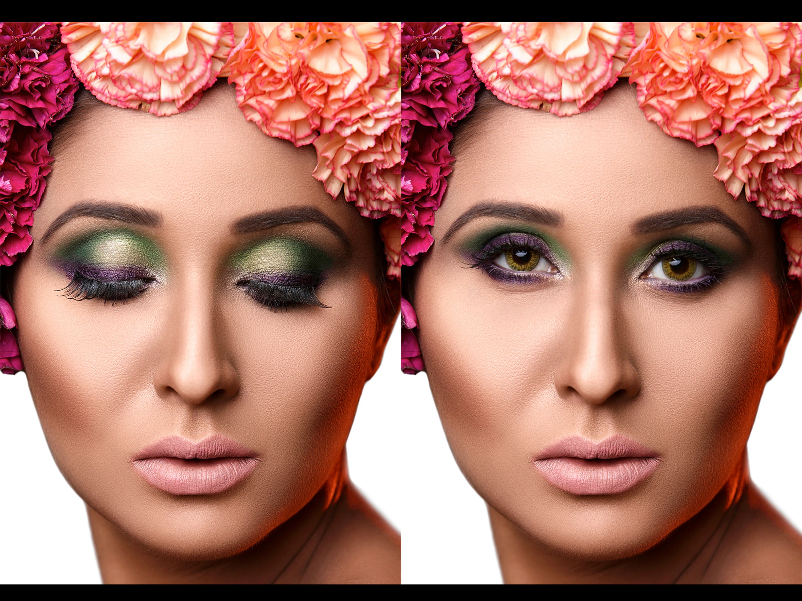 Beauty— personal Story